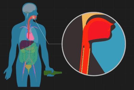 男性患癌率高于女性原因,身高每高10cm患癌几率大