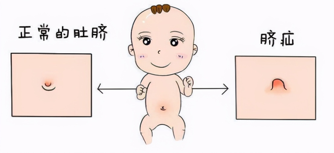 肚脐眼长得难看怎么办,肚脐眼很难看能做手术吗