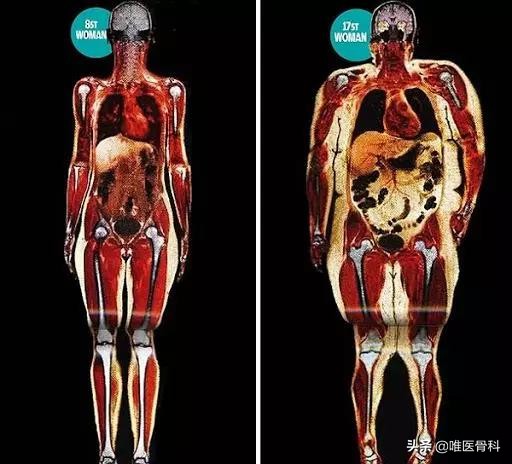 如何练成大长腿女神必看,如何练成又细又长的大长腿