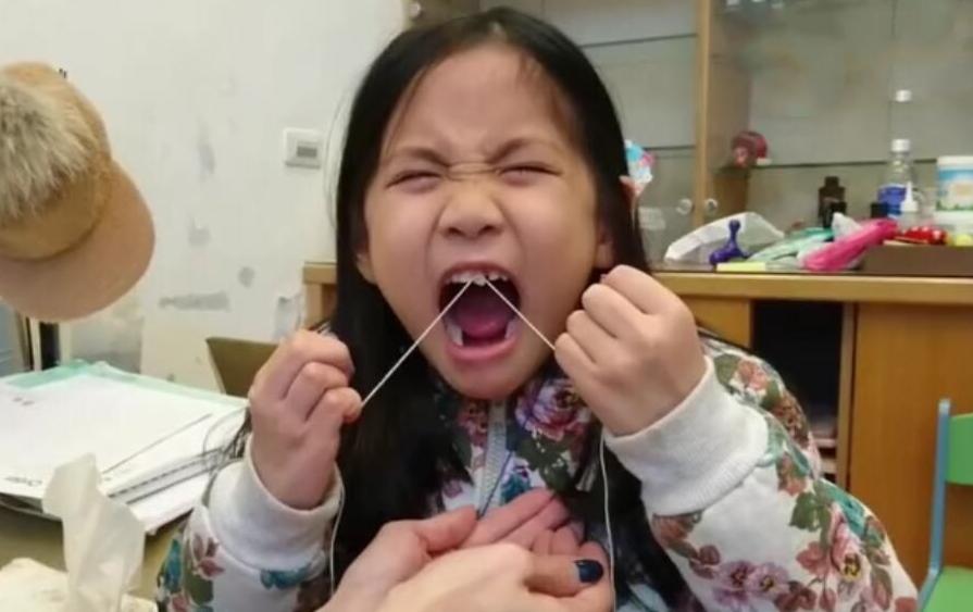 孩子换牙掉下来的牙怎么处理,孩子换牙乳牙不掉有什么好办法