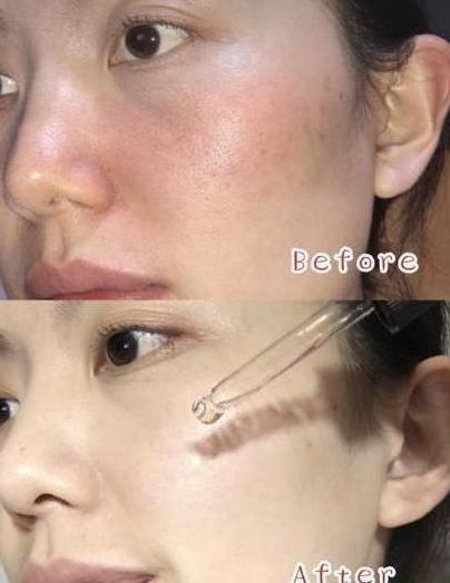 用了好多年的护肤品,用过的最好用精华