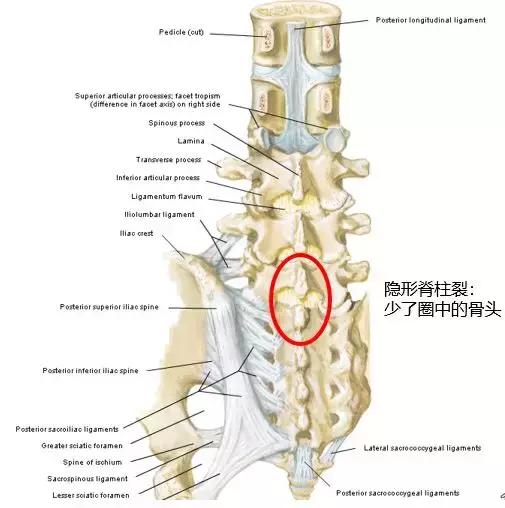 年纪轻轻就腰痛？警惕这2种先天发育不良！（附解决办法）