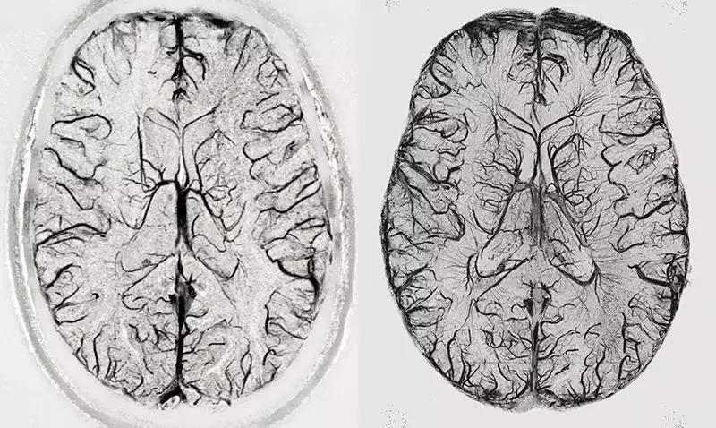 最完整人类大脑三维图像,人类大脑的结构图