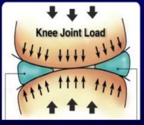 膝盖半月板损伤三年了还能自愈吗,内侧半月板后角损伤2-3级能自愈