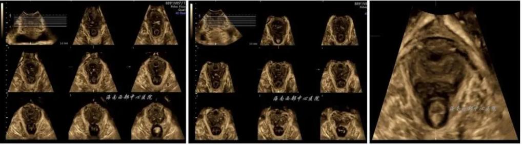 超声的未来,超声设备的发展趋势