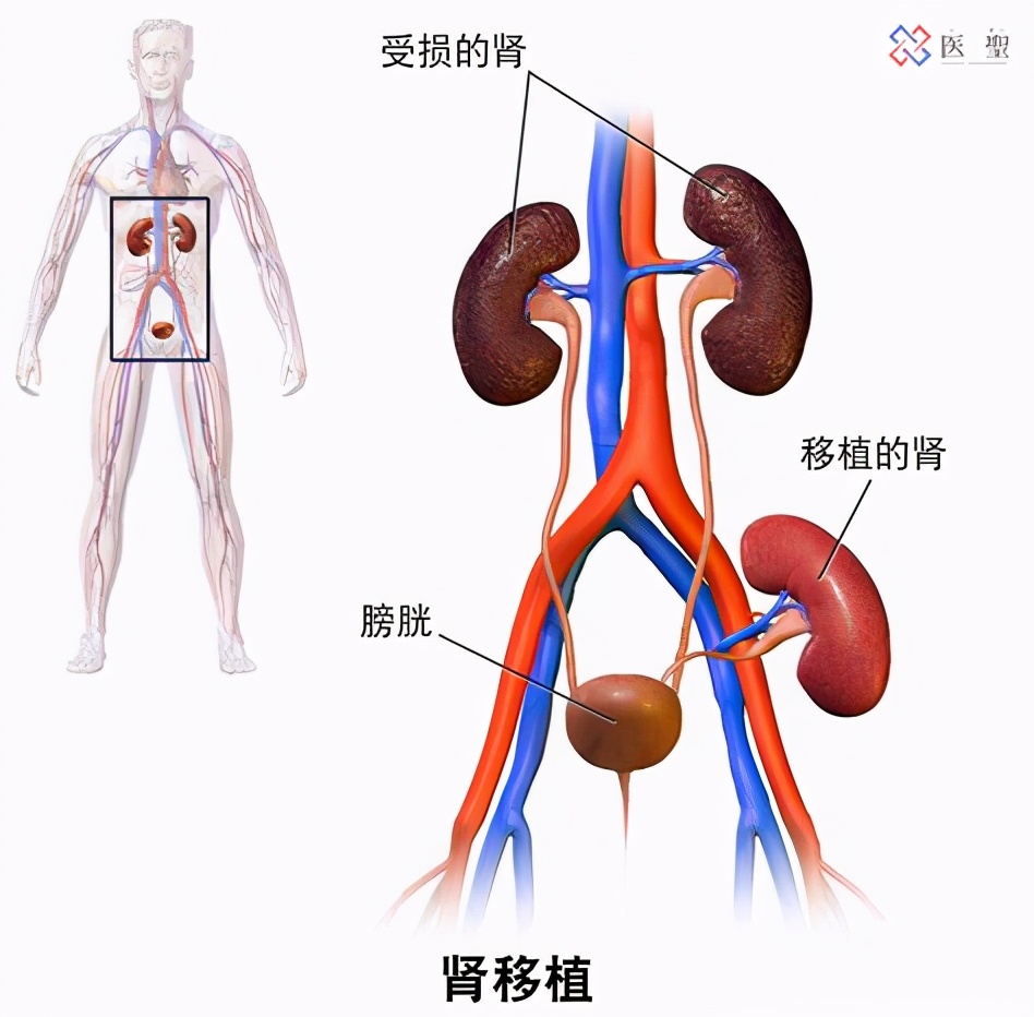 上海干细胞肾再生,干细胞再生肾最新技术