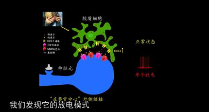 抑郁症新型治疗方法,最新抑郁症治疗方法