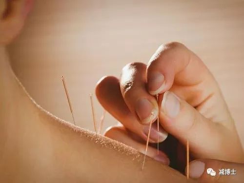 令人讨厌的肥胖纹怎么消除？不用祛纹霜也能消除！