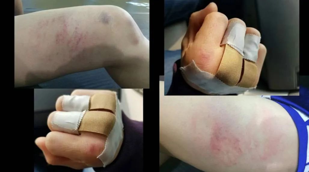 中国女拳王vs日本拳王,中国女拳王对日本女拳王死亡之战