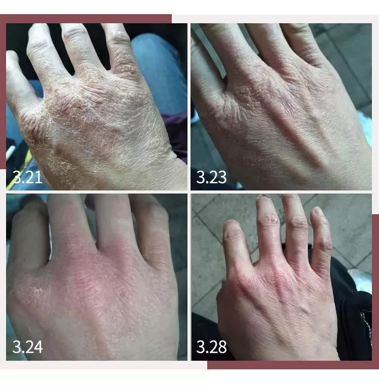 蔡依林皮肤特护霜,蔡依林胶原蛋白粉保养皮肤