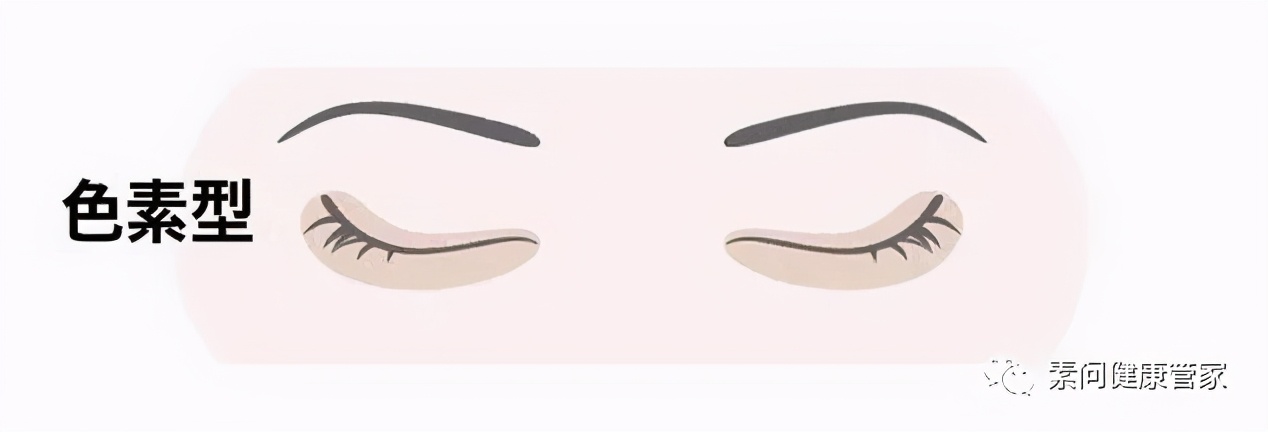 你的黑眼圈是天生的吗,化疗为什么有黑眼圈