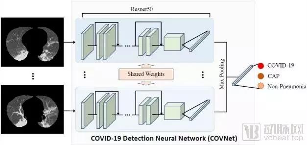 新冠肺炎ai检测准确率,新冠肺炎鼻腔检测准确率高不高