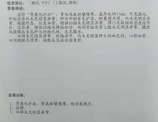 胃癌新辅助化疗实战病例分析