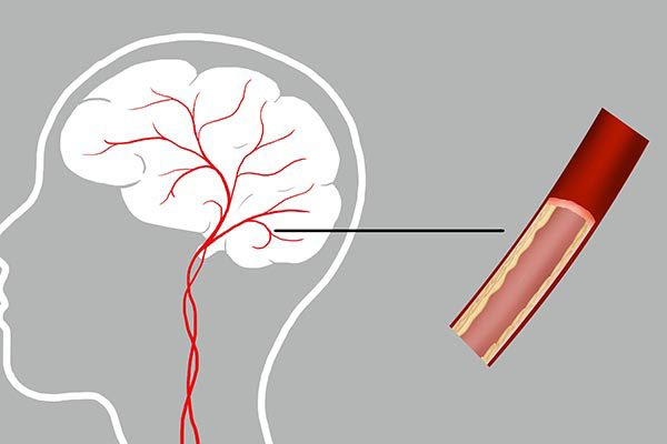 过多补充钙和维生素d的危害,维生素d补充过多会口唇干裂吗