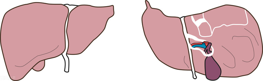 乙肝肝硬化会发展成肝癌吗,乙肝大三阳发展成肝硬化肝癌概率