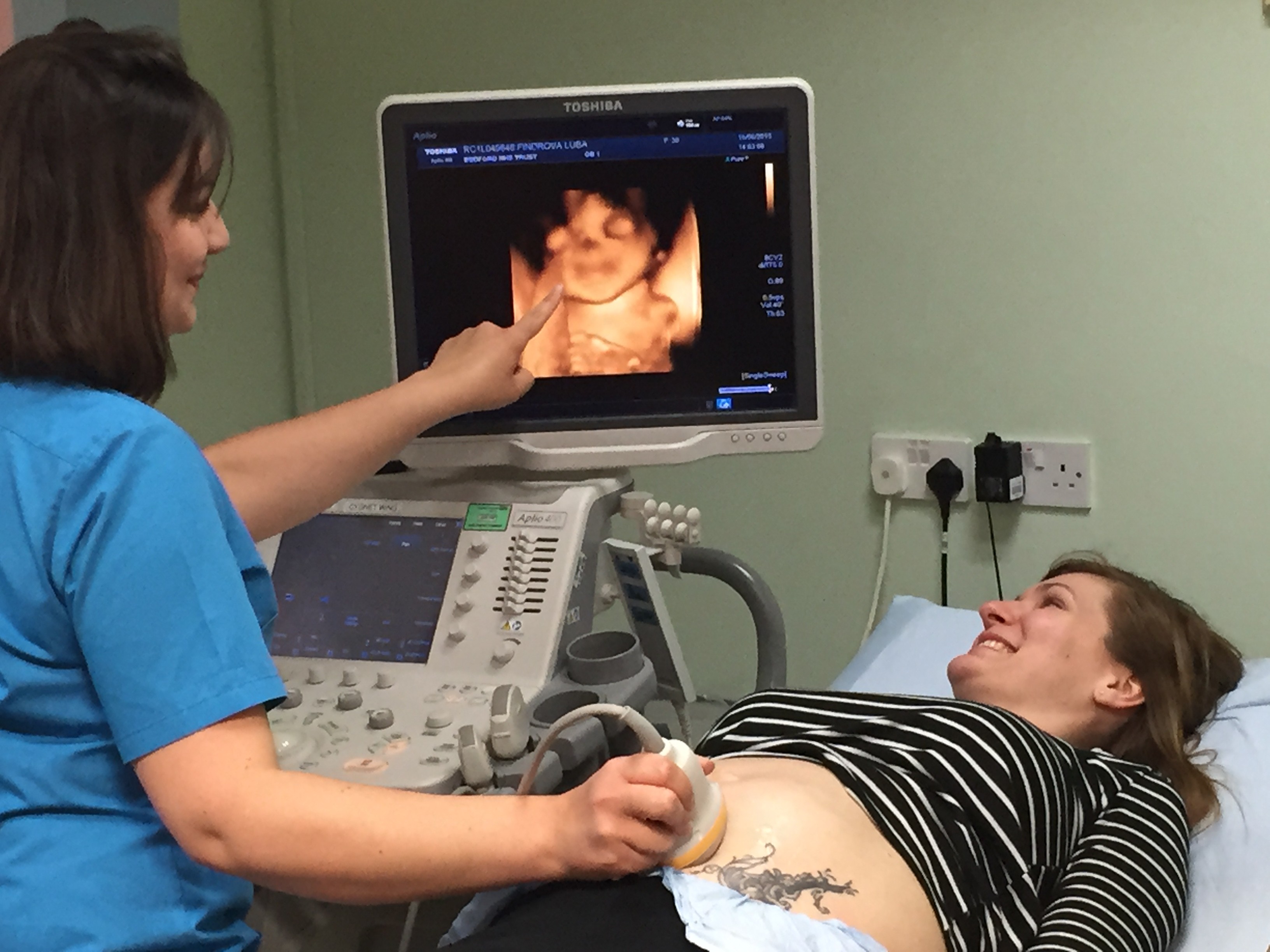 孕期四维超声结果参考,孕期四维检查结果怎么看