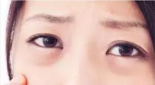 30-40岁最适合的中国眼霜,40岁以后用哪一款眼霜