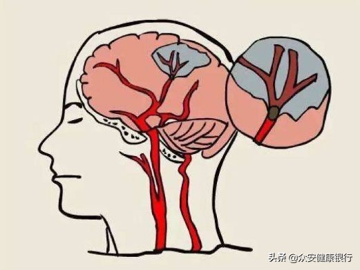 干细胞能激活脑细胞吗,间充质干细胞可否唤醒大脑