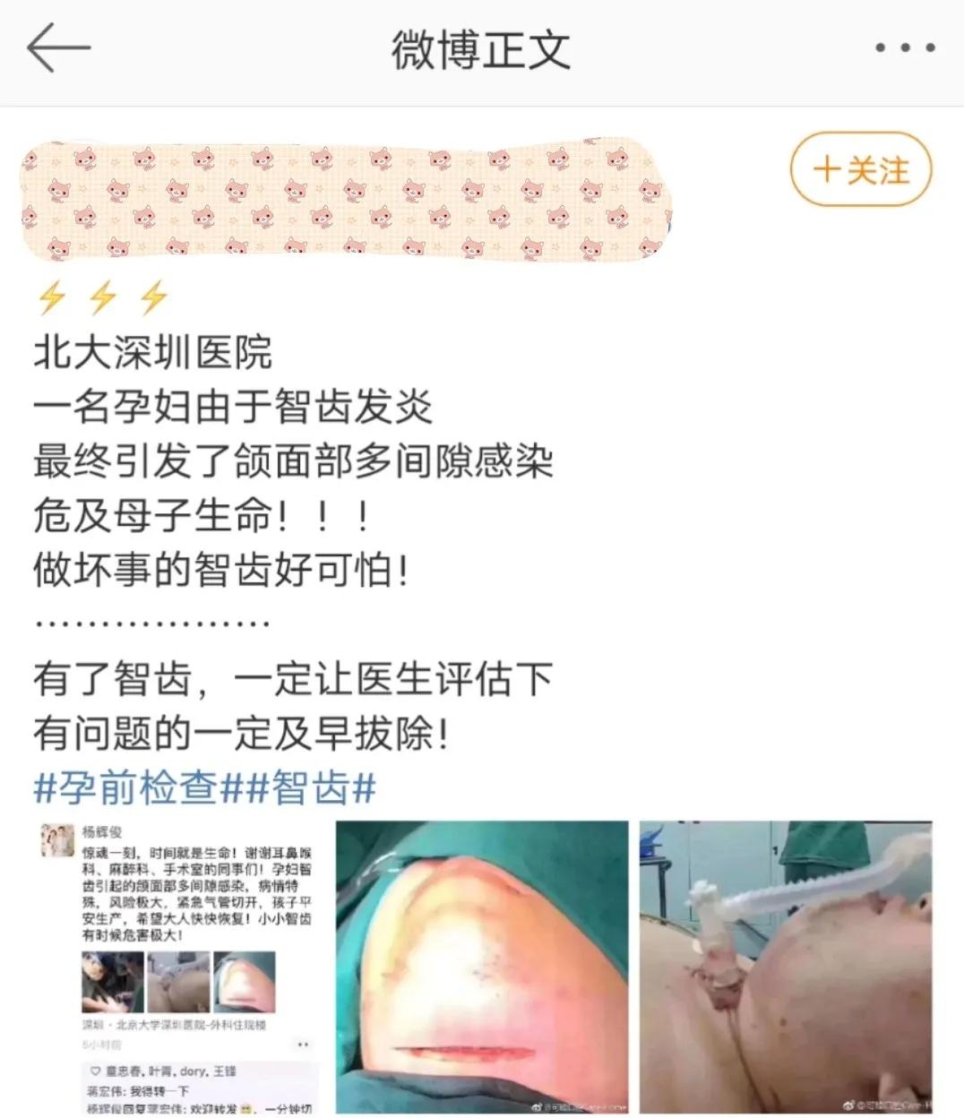 孕期牙疼智齿发炎怎么办,孕期智齿发炎只能硬抗