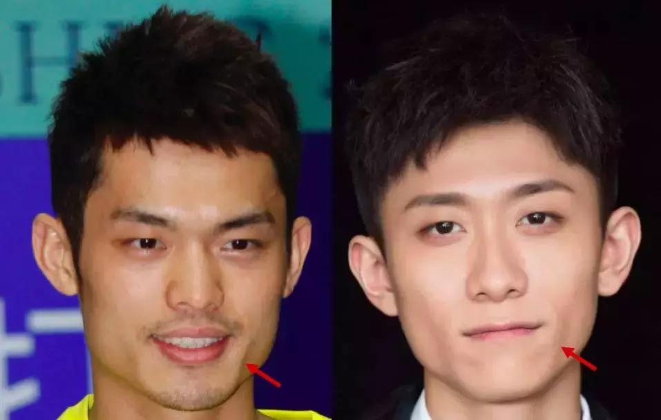 脸大脸变小怎么修,脸大怎么改善脸型