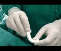 想去隆鼻,隆鼻到底值不值得入手