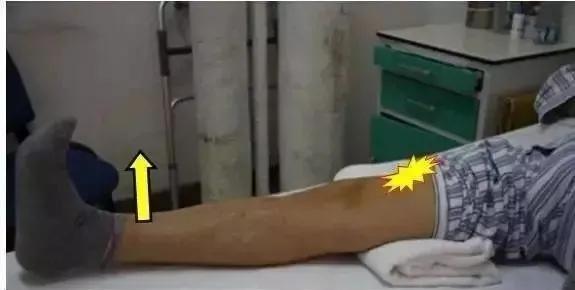 膝关节韧带断裂重建术后恢复锻炼,膝关节韧带断裂术后康复锻炼