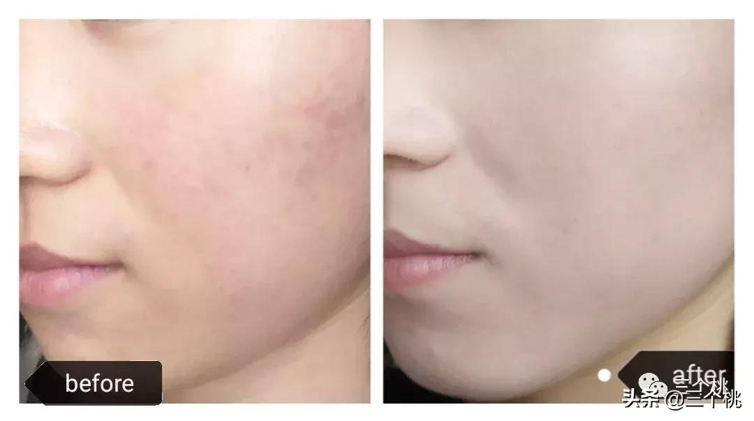 十大公认好用的粉底液评测,十大口碑最好的粉底液夏天