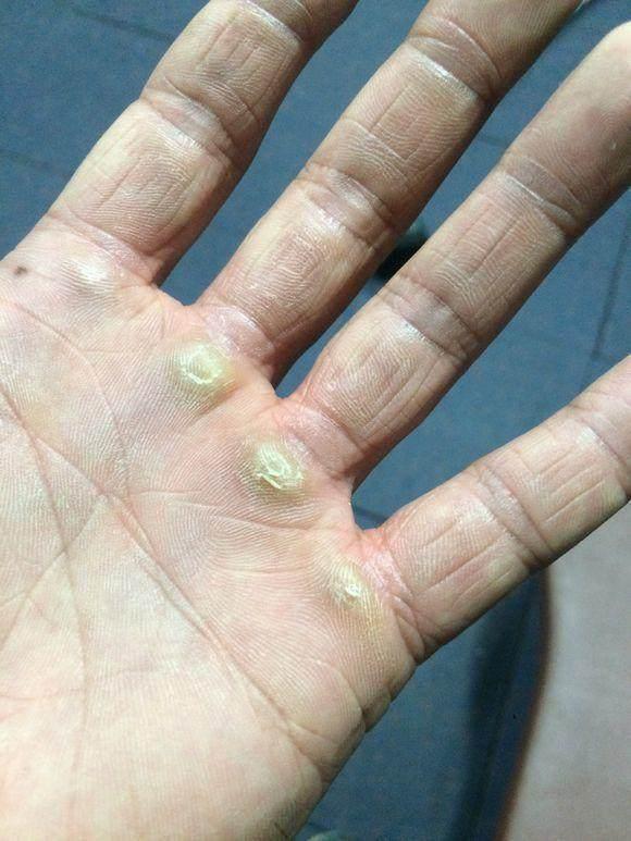 咬文嚼字中的咬文嚼字,胼胝体和胼胝质