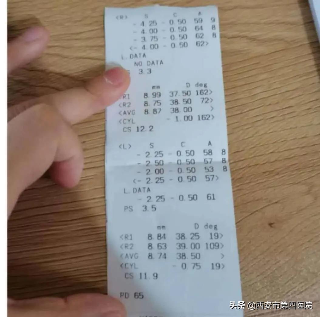 近视眼镜近处清楚远处模糊,近视看清楚近处较模糊