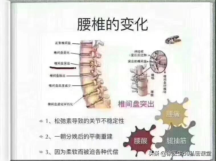 普拉提环产后修复,梵一瑜伽普拉提产后修复私教