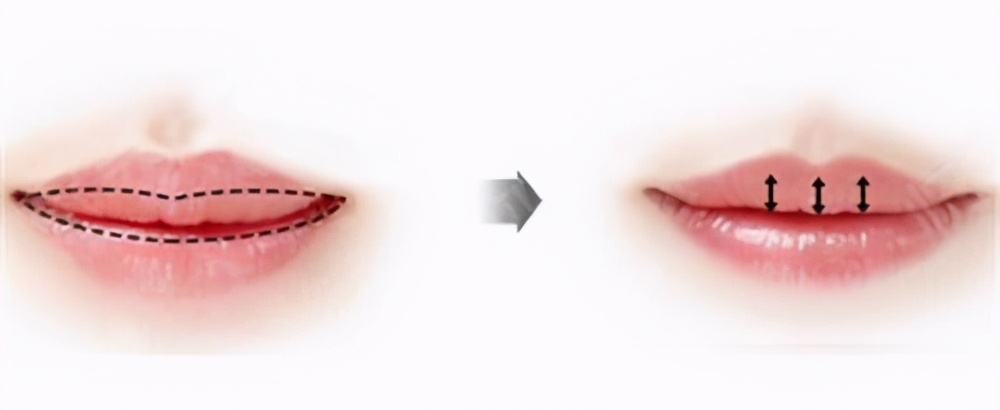 一个精致的唇让你美出高级感,五种好看的唇型看看你属于哪一种