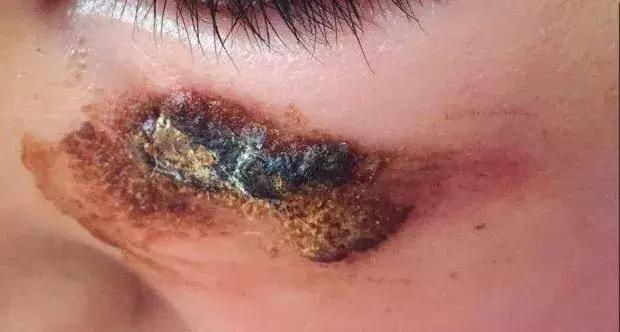 万能天然芦荟胶,一款被称为万能胶的完美芦荟胶