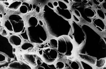 欣兰冻膜怎么去黑头,欣兰冻膜用完怎么去黑头