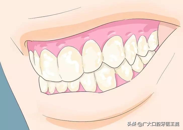 牙齿腐烂要怎么才能修复好,老人的牙齿全部腐烂怎么办