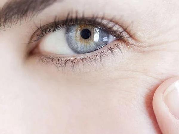 细纹干纹怎么消除,怎么知道自己皱纹是细纹还是干纹