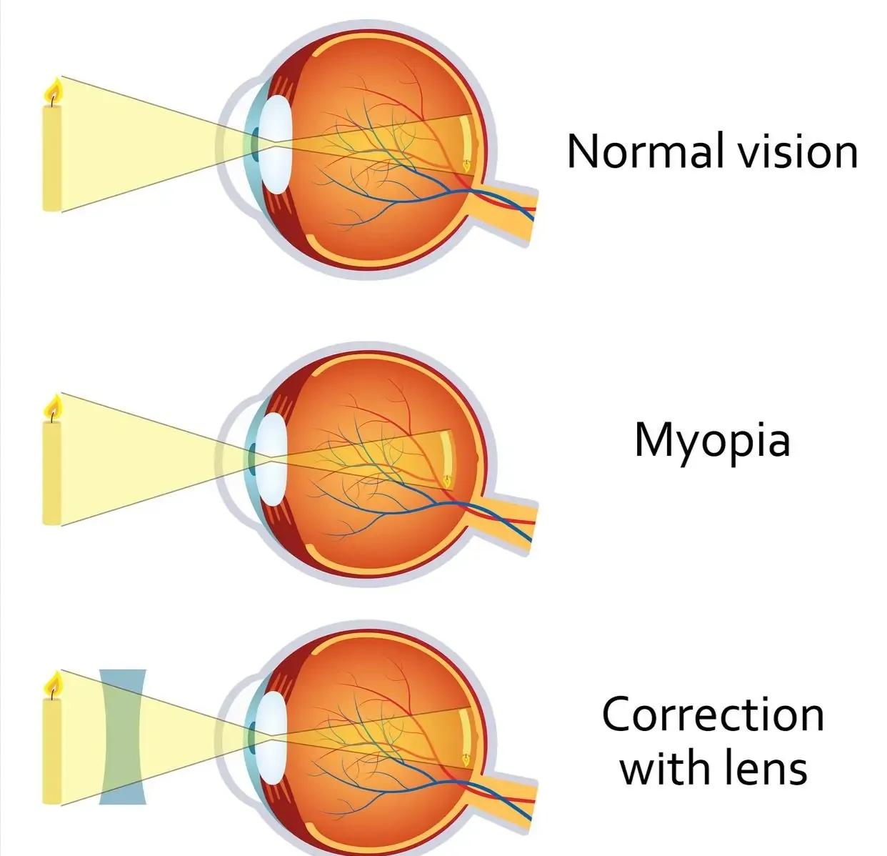 物理初中凸透镜成像知识点,初中物理凸透镜成像中考填空题