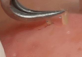 收缩毛孔做什么效果最好,收缩毛孔公认最好的方法