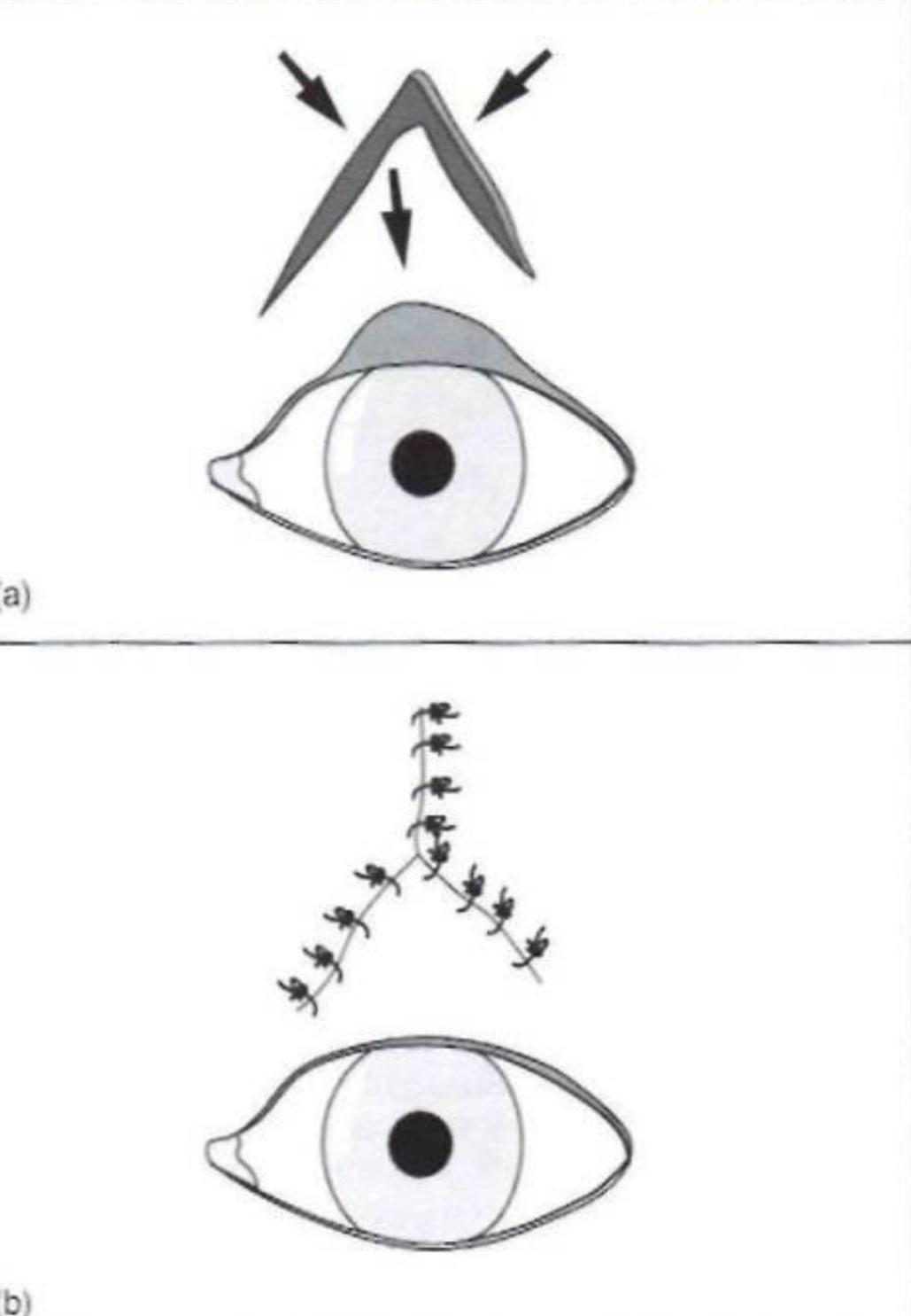 狗狗割双眼皮的危害,狗狗割双眼皮的后果