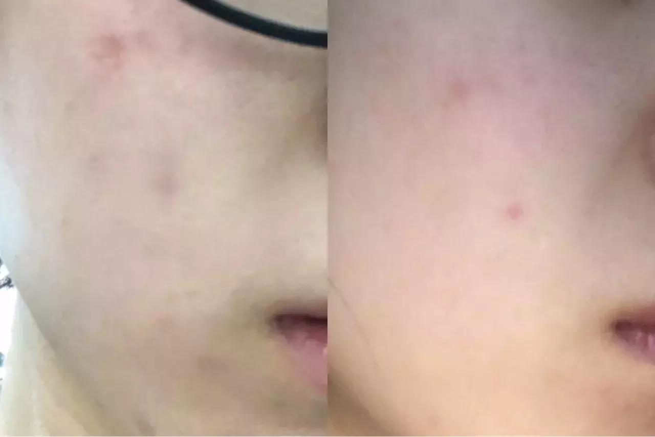 美白界的巨头,美白三巨头