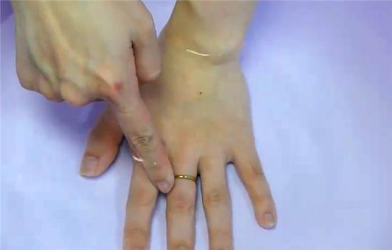 戒指戴太久取不出来怎么办,戒指太紧取不下来的最佳方法