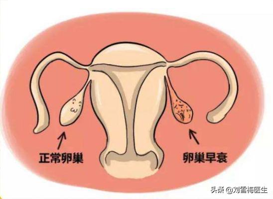 卵巢保养对女人有什么好处,如何保养卵巢是每个女人的必修课