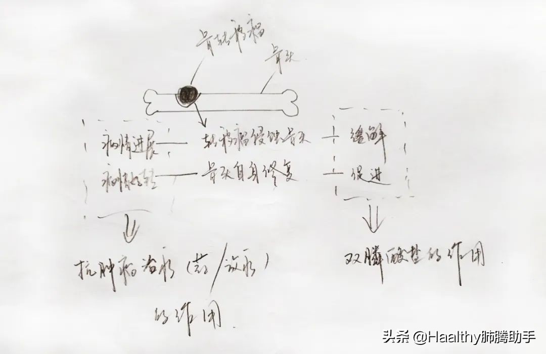 肺癌骨转移的十大症状,肺癌骨转移七大疑惑