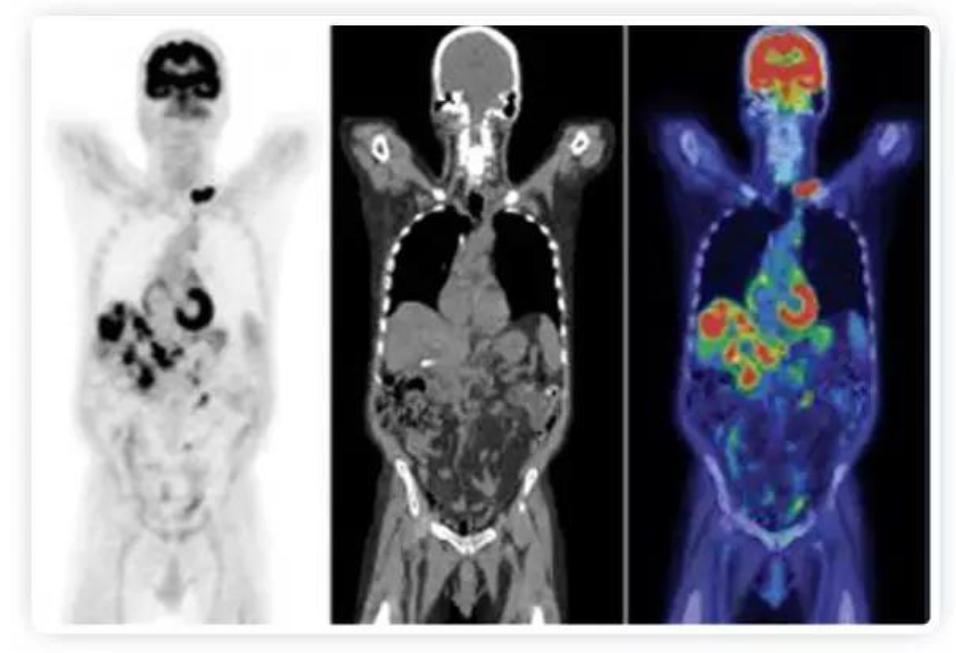 医用加速器研发岗位有前途吗,医用加速器有几种