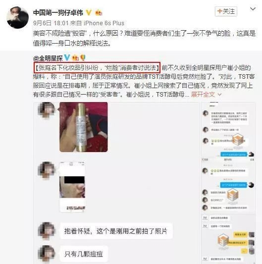 张庭微商拟赴台上市！纳税21亿站台明星无数狂吸金深陷烂脸风波