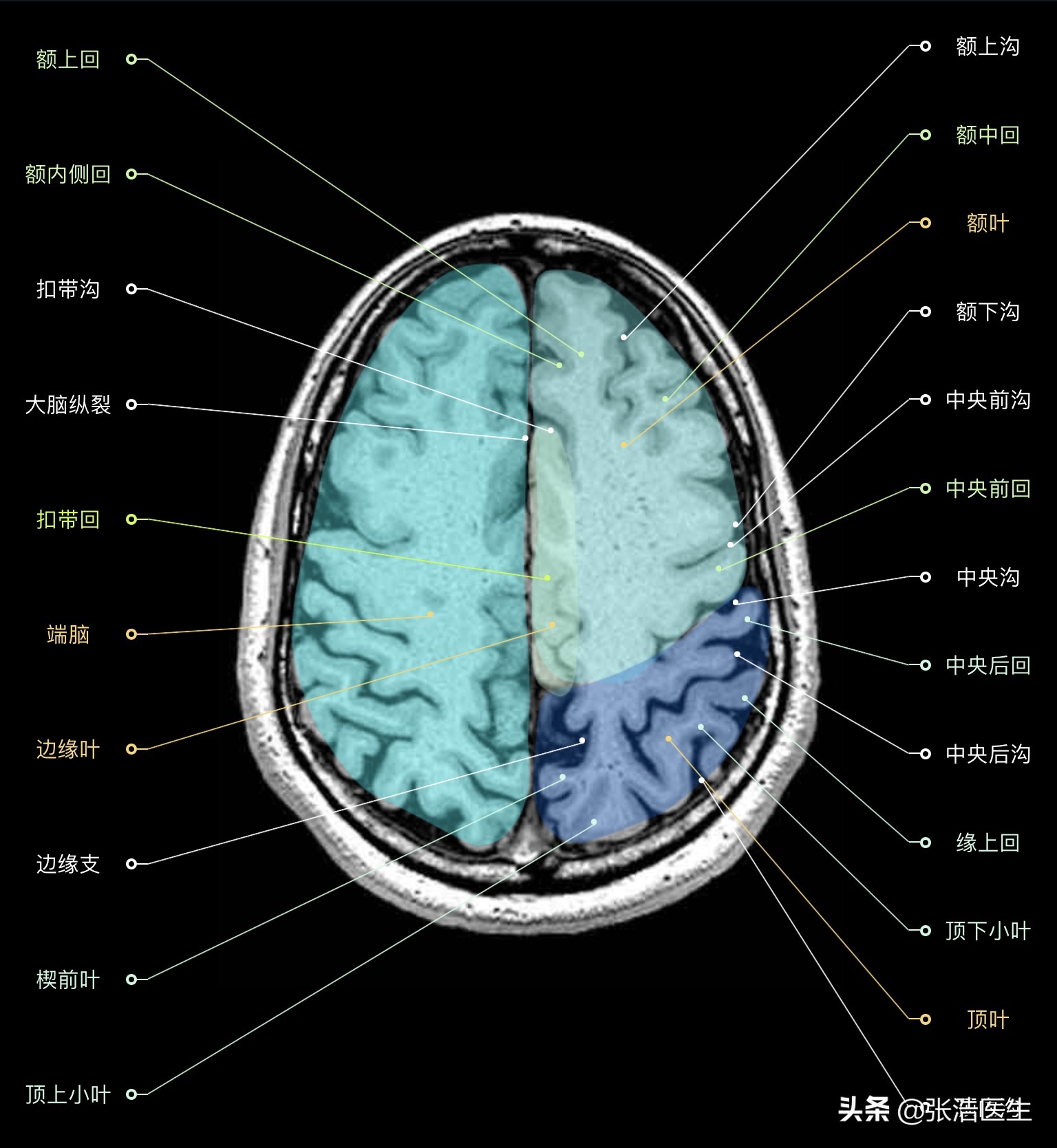 颅脑mri解剖影像检查是什么意思,颅脑mri断层解剖视频课件