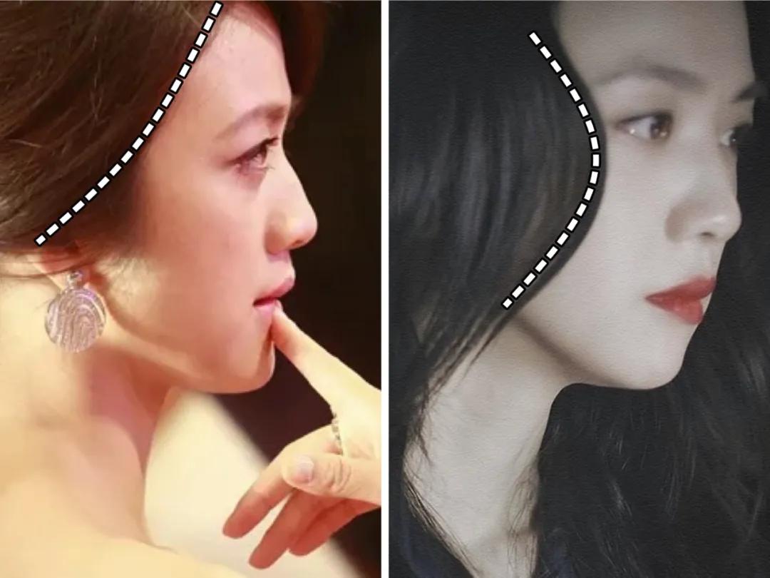 扁平脸变美思路,扁平脸的逆袭思路