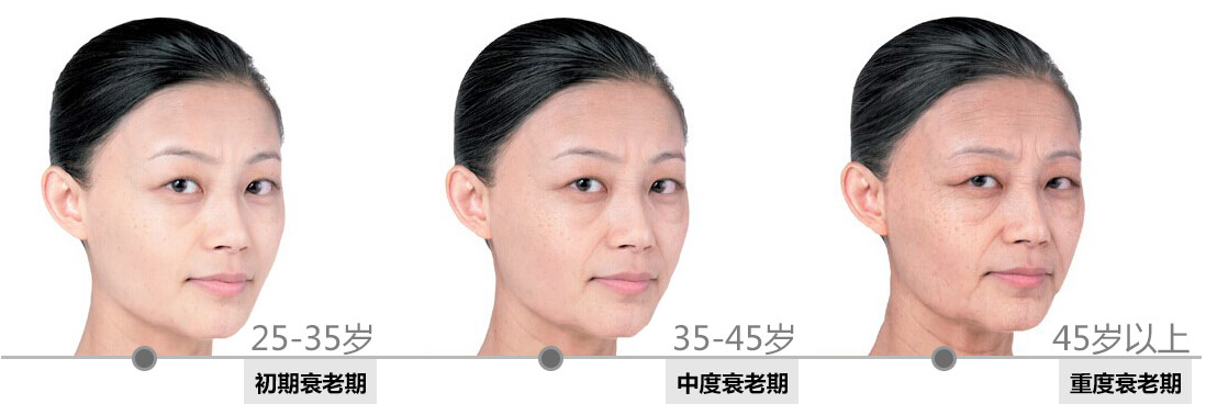 高效的面部除皱方法你选对了吗,现在最好的面部除皱是用什么方法