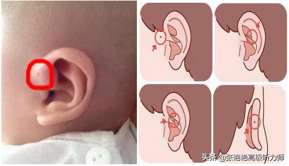 耳仓和拴马桩是什么,耳垂耳仓是富贵的征兆
