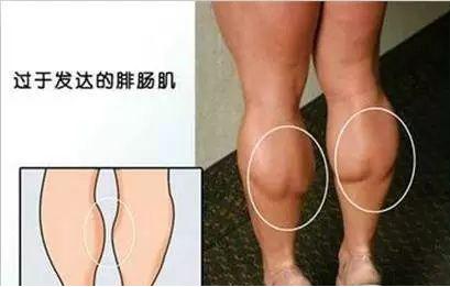 想瘦腿怎么成肌肉腿了,肌肉型小腿瘦腿最快的方法