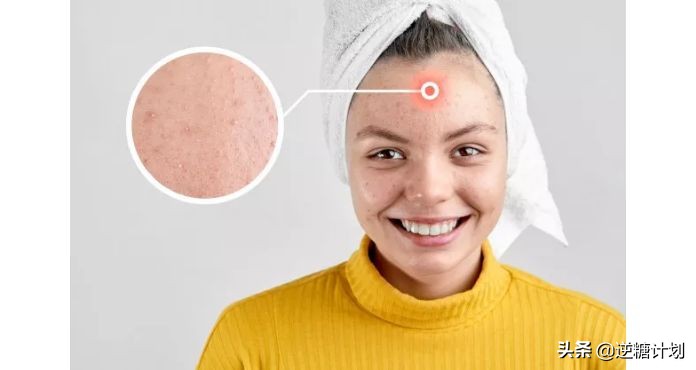 油性肌肤夏天适合什么护肤品,油性皮肤夏天怎么改善出油